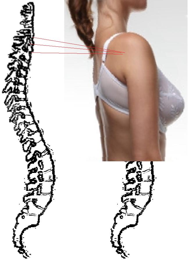cervicale.jpg (63627 byte)